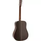 MARTIN - D-28 1935 SUNBURST