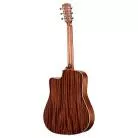 ALVAREZ - MD60 CE SHADOWBURST