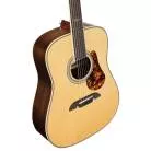 ALVAREZ - MD70EHFHB MASTERWORKS